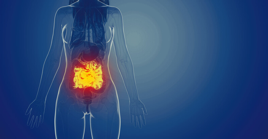 ¿QUE ES EL SINDROME DE INTESTINO IRRITABLE? IBS